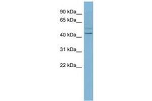 Image no. 1 for anti-Solute Carrier Family 46 (Folate Transporter), Member 1 (SLC46A1) (N-Term) antibody (ABIN6741754)