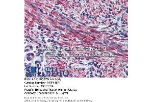Image no. 1 for anti-Periostin (POSTN) (Middle Region) antibody (ABIN2776883)