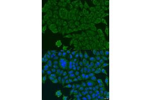 Image no. 4 for anti-BCS1-Like (BCS1L) antibody (ABIN6137520)