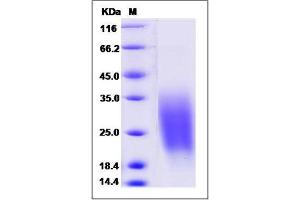 Image no. 1 for CAMP Responsive Element Binding Protein 3-Like 1 (CREB3L1) (AA 396-519) protein (His tag) (ABIN2650320)