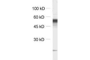 GABRB3 antibody  (AA 344-429)