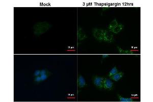 Image no. 3 for anti-Sequestosome 1 (SQSTM1) (Internal Region) antibody (ABIN2854836)
