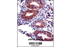 Image no. 2 for anti-PHD Finger Protein 16 (PHF16) (AA 779-806), (C-Term) antibody (ABIN1537593)