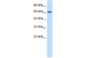 Image no. 2 for anti-Zinc Finger and BTB Domain Containing 45 (ZBTB45) (Middle Region) antibody (ABIN2779239)