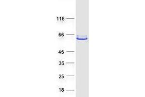 Image no. 1 for POC1 Centriolar Protein Homolog B (POC1B) protein (Myc-DYKDDDDK Tag) (ABIN2735521)