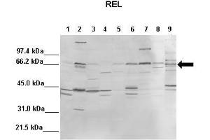 Image no. 3 for anti-REL proto-oncogene (c-Rel) (Middle Region) antibody (ABIN2779887)