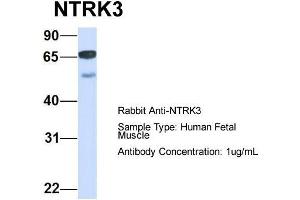 Image no. 2 for anti-Neurotrophic tyrosine Kinase, Receptor, Type 3 (NTRK3) (C-Term) antibody (ABIN2784511)