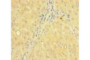 Immunohistochemistry of paraffin-embedded human liver tissue using ABIN7143108 at dilution of 1:100