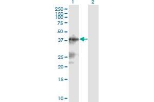 anti-Chromosome 13 Open Reading Frame 31 (C13orf31) (AA 1-430) antibody