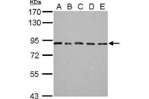 Image no. 1 for anti-Proteasome (Prosome, Macropain) 26S Subunit, Non-ATPase, 14 (PSMD14) (Center) antibody (ABIN2856031)