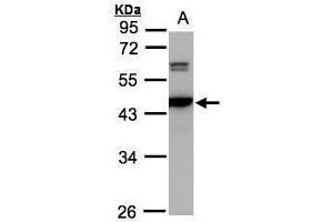Image no. 2 for anti-Calcium/calmodulin-Dependent Protein Kinase IV (CAMK4) (Center) antibody (ABIN2856245)