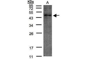 Image no. 1 for anti-Trimethyllysine Hydroxylase, epsilon (TMLHE) (Center) antibody (ABIN2854410)