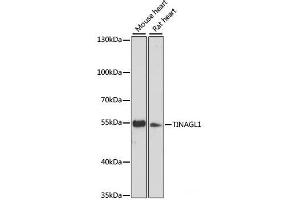 Western blot analysis of extracts of various cell lines using TINAGL1 Polyclonal Antibody at dilution of 1:3000.