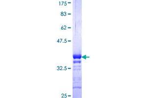 Image no. 1 for Basic Leucine Zipper ATF-like Transcription Factor (BATF) (AA 34-125) protein (GST tag) (ABIN1346438)