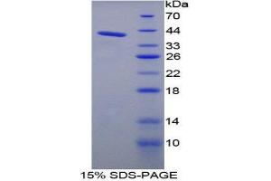 Image no. 1 for Kininogen 1 (KNG1) (AA 22-379) protein (His tag) (ABIN1980912)