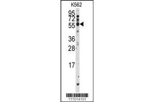 Image no. 1 for anti-Cytochrome P450, Family 2, Subfamily F, Polypeptide 1 (CYP2F1) (AA 395-424), (C-Term) antibody (ABIN392366)