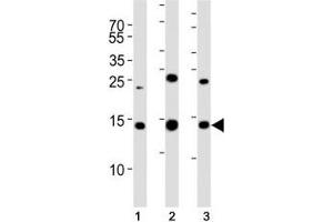 anti-Small Ubiquitin Related Modifier 2 (SUMO2) (AA 63-93) antibody