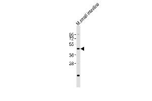 LMX1A 抗体  (C-Term)