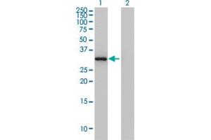 Image no. 1 for anti-Annexin A3 (ANXA3) (AA 1-323) antibody (ABIN559876)