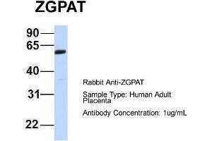 Image no. 1 for anti-Zinc Finger, CCCH-Type with G Patch Domain (ZGPAT) (Middle Region) antibody (ABIN2775555)
