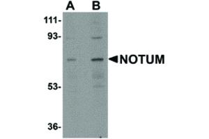 Image no. 1 for anti-Notum Pectinacetylesterase Homolog (NOTUM) (N-Term) antibody (ABIN6657113)