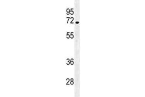 Image no. 3 for anti-Numb Homolog (NUMB) (AA 1-30) antibody (ABIN3032082)