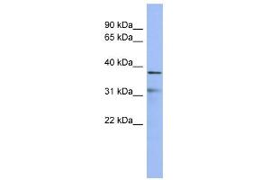 Image no. 1 for anti-Hairy/enhancer-of-Split Related with YRPW Motif 2 (HEY2) (Middle Region) antibody (ABIN2780874)