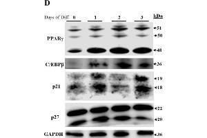 Image no. 7 for anti-Cyclin-Dependent Kinase Inhibitor 1B (p27, Kip1) (CDKN1B) (AA 150-198) antibody (ABIN672621)