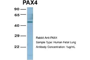 Image no. 1 for anti-Paired Box 4 (PAX4) (Middle Region) antibody (ABIN2779444)