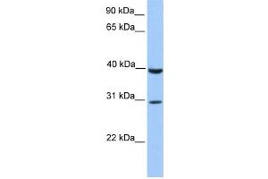 Image no. 1 for anti-JAZF Zinc Finger 1 (JAZF1) antibody (ABIN2458461)