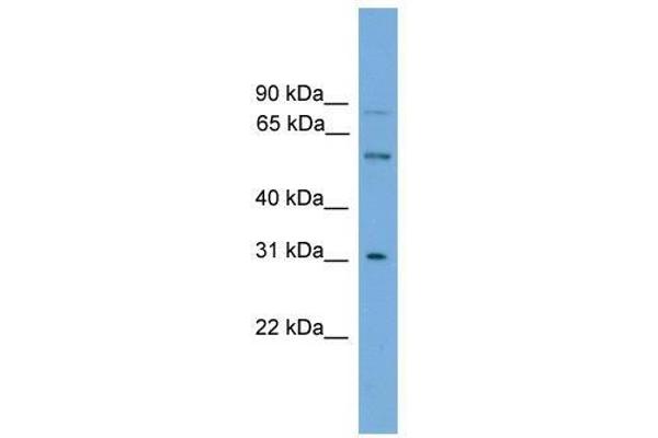 anti-UDP Glucuronosyltransferase 1 Family, Polypeptide A5 (UGT1A5) (N-Term) antibody
