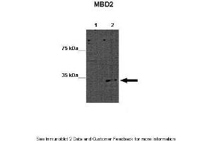 Image no. 2 for anti-Methyl-CpG Binding Domain Protein 2 (MBD2) (Middle Region) antibody (ABIN2778640)