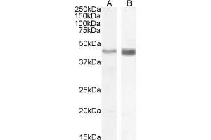 Image no. 1 for anti-Actin, alpha 2, Smooth Muscle, Aorta (ACTA2) (N-Term) antibody (ABIN185271)
