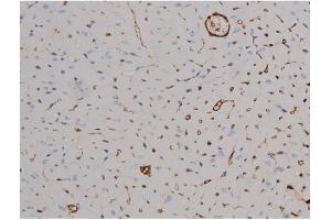Image no. 3 for anti-Signal Transducer and Activator of Transcription 6, Interleukin-4 Induced (STAT6) (pThr645) antibody (ABIN6255720)