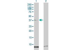 Image no. 1 for anti-Single-Stranded DNA Binding Protein 2 (SSBP2) (AA 1-361) antibody (ABIN525324)