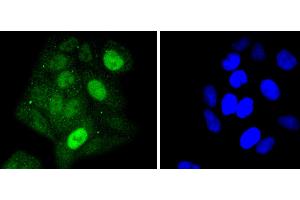 Immunofluorescence (Cultured Cells) (IF (cc)) image for anti-Signal Transducer and Activator of Transcription 5A (STAT5A) antibody (ABIN5557532)