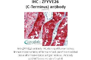 Image no. 1 for anti-Zinc Finger, FYVE Domain Containing 26 (ZFYVE26) (C-Term) antibody (ABIN1740918)