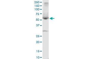 Image no. 3 for anti-serpin Peptidase Inhibitor, Clade A (Alpha-1 Antiproteinase, Antitrypsin), Member 10 (SERPINA10) (AA 22-444) antibody (ABIN565547)