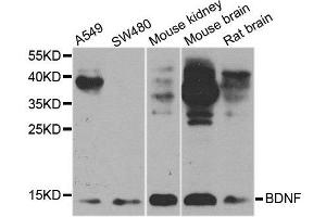 Image no. 2 for anti-Brain-Derived Neurotrophic Factor (BDNF) antibody (ABIN3021893)