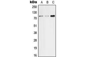 Image no. 1 for anti-Solute Carrier Family 5 (Sodium/glucose Cotransporter), Member 2 (SLC5A2) (Center) antibody (ABIN2707040)