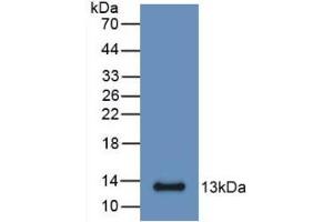 Image no. 2 for anti-S100 Calcium Binding Protein A6 (S100A6) (AA 1-89) antibody (ABIN5662106)