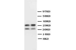 Image no. 1 for anti-Myelin Basic Protein (MBP) (AA 182-197), (C-Term) antibody (ABIN3043688)