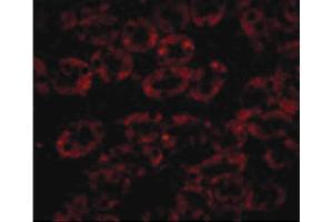 Image no. 2 for anti-Niemann-Pick Disease, Type C1 (NPC1) (C-Term) antibody (ABIN6655360)