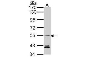 Image no. 1 for anti-Interferon Regulatory Factor 5 (IRF5) (C-Term) antibody (ABIN2855970)