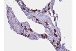 Image no. 1 for anti-ELK1, Member of ETS Oncogene Family (ELK1) (pSer389) antibody (ABIN6256309)