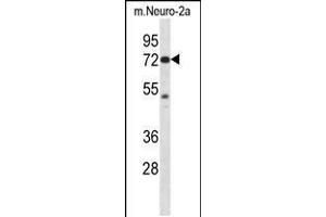 Image no. 2 for anti-P21-Activated Kinase 4 (PAK4) (AA 187-216) antibody (ABIN5534399)