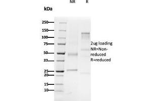 Image no. 1 for anti-CD79b Molecule, Immunoglobulin-Associated beta (CD79B) (C-Term) antibody (ABIN6941276)