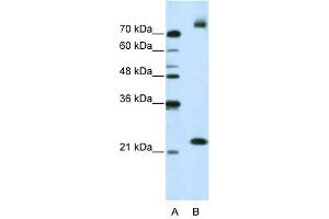 Image no. 2 for anti-Frizzled Family Receptor 9 (FZD9) antibody (ABIN630125)