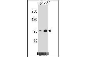 Image no. 1 for anti-Catenin (Cadherin-Associated Protein), beta 1, 88kDa (CTNNB1) (AA 78-106), (N-Term) antibody (ABIN1881239)