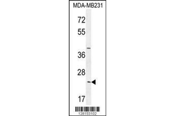 anti-Synaptonemal Complex Central Element Protein 2 (SYCE2) (AA 1-30), (N-Term) antibody